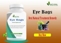 Tired of having dark circles and bags under your eyes? Check out these simple Eye Bags Home Remedies that can help you get rid of them quickly and naturally! From cucumbers to tea bags, these natural remedies are sure to give you the bright, refreshed look you desire
