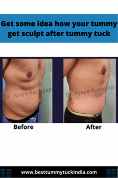 U.S. Board certified Plastic & cosmetic surgeon Serving in Delhi NCR  (real patient before & after)
Do schedule your consultation
Call; +919958221983
Email : info@besttummytuckindia.com