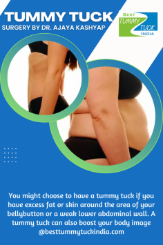 You might choose to have a tummy tuck if you have excess fat or skin around the area of your belly-button or a weak lower abdominal wall. A tummy tuck can also boost your body image 