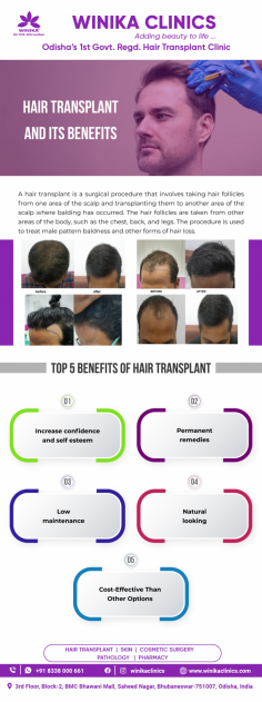 A hair transplant is a surgical procedure that involves taking hair follicles from one area of the scalp and transplanting them to another area of the scalp where balding has occurred. The hair follicles are taken from other areas of the body, such as the chest, back, and legs. The procedure is used to treat male pattern baldness and other forms of hair loss.


See more: https://www.winikaclinics.com/
