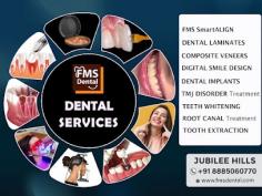 Dental Services In Jubilee Hills