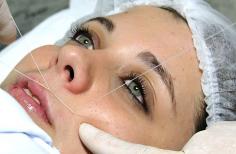 Get the best eyebrow upper lip threading in Bedford MA. We are the best laser hair removal and face hair removal threading salon in Bedford MA. Call us: 401-808-9880.
