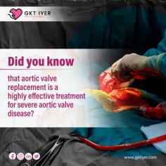 Whether through traditional open-heart surgery or minimally invasive techniques, aortic valve replacement has revolutionized cardiovascular care. Surgeons and medical teams around the world are bringing hope to countless individuals with this life-changing procedure. 

Know more: https://gktiyer.com/