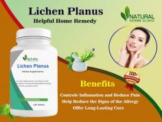 Herbal Treatment for Lichen Planus: Nature's Way to Alleviate
When applied topically, it can help alleviate itching and discomfort associated with Natural Treatment for Lichen Planus. Its anti-inflammatory properties can also aid in reducing redness and inflammation.
https://dribbble.com/shots/22444769-Herbal-Treatment-for-Lichen-Planus-Nature-s-Way-to-Alleviate
