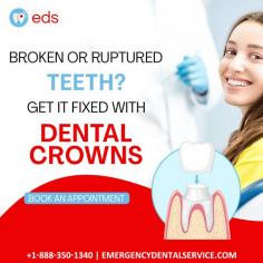 Dental Crowns | Emergency Dental Service

Dealing with broken or ruptured teeth? Don't worry; Emergency Dental Service got you covered!  Get your smile fixed with dental crowns. Our expert team is here to help you!
Schedule an appointment at 1-888-350-1340.
