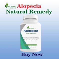 Alopecia Natural Treatments, The Role of Diet and Remedies
