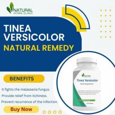 When it comes to tackling tinea versicolor, a fungal skin condition that affects countless individuals worldwide, you're not alone in seeking Natural Ways to Treat Tinea Versicolor and effective solutions.
