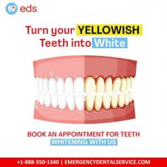 Yellow to White Teeth | Emergency Dental Service
Say goodbye to yellowish teeth and hello to a dazzling smile! Emergency Dental Service offers professional teeth whitening that will transform your pearly whites from dull to brilliant. Don't wait any longer to achieve the perfect smile. Schedule an appointment at 1-888-350-1340.