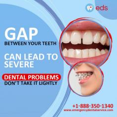 Dental Problems | Emergency Dental Service

Don't ignore the gap between your teeth! It can lead to serious dental issues. Reach out to Emergency Dental Service, a reliable dental referral company, for the right solution. Prioritize your smile's health today!  Schedule an appointment at 1-888-350-1340.

