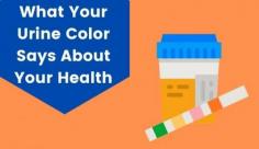 Urine is one of the things you can quickly check to see how you are doing. Learn more about the seven varieties of urine lab test that reflect your general health by visiting Livlong.