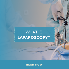 Laparoscopy: Gain insight on laparoscopy myomectomy for fertility treatment. Discover how laparoscopy operation is performed.