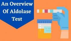 Explore details on Serum Aldolase Test for muscle disease by measuring the aldolase serum in your blood. Learn more about the aldolase blood test at Livlong.
