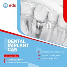 Dental Implant Can | Emergency Dental Service

Transform your smile with dental implants! Not only do they enhance your facial appearance, but they also provide essential support to your remaining teeth. Say goodbye to bone loss and hello to a confident, healthy smile. Schedule an appointment at 1-888-350-1340.