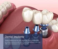 What Are Dental Implants?
Dental implants artificially replace a tooth, including the tooth root. They consist of a small post or screw surgically inserted into the jawbone. Once inserted, the screw gradually integrates or bonds with the jawbone during osseointegration. During this process, new bone cells grow on and around the post, which is often specially treated to encourage this growth.

Once fully fused in the jawbone, a special attachment called an abutment is fitted onto the post, protruding above the gumline. The abutment supports the replacement tooth in the form of a dental crown or dental bridge. Both these restorations are permanently screwed or cemented in place and are only removable by a dentist.

Another option is to have a removable appliance called an implant denture or implant overdenture, where a denture has special attachments on its fitting surface that clip onto the implants, but you can take out the denture for regular cleaning and maintenance. Dental implants can replace single or multiple teeth or even complete arches, providing patients with teeth that look and feel strong, stable, and natural.

What Are Mini Dental Implants?
Mini dental implants are much narrower than traditional implants and the insertion process differs slightly. Instead of making an incision into the gum to expose the bone underneath so the implant can be inserted, a mini dental implant is inserted directly through the gum and into the bone. Mini dental implants are suitable for securing loose dentures and for situations where there is inadequate room to place an ordinary dental implant, for example, when restoring a small lower incisor and where space is very limited.

Who Can Have Dental Implants?
Generally, most people are suitable for dental implants.

Good general health
You need to be over 18 so your jawbone has finished growing and developing, but being older is not usually a barrier to treatment. You must have good general health as if you have poorly controlled diabetes or other problems affecting your immune system, it can impact healing after implant surgery and increase the chance of complications.

Good gum health
Good gum health is also very important, so if you have active gum disease, we must treat this first before you can receive dental implants. Smokers should be prepared to quit, ideally for several months before their treatment and for good afterward, but at least for the duration of healing. Smoking interferes with the body’s ability to heal after implant surgery and can significantly increase the risk of implant failure.

Good jawbone density
Good jawbone density is another important factor, as dental implants must be surrounded by a specific amount of strong, healthy bone with which to integrate and bond. It’s not unusual for people to need a bone graft before dental implants. Bone loss can occur because of trauma, but it often happens if you lost teeth quite some time ago and where the bone has naturally resorbed. It can also be destroyed by advanced gum disease, called periodontal disease.

Read more: https://www.centurymedicaldental.com/dentistry/implants/

Century Dentistry Center
827 11th Ave Ground Floor
New York, NY 10019
(212) 929-2202
Web Address https://www.centurymedicaldental.com/dentistry/

Our location on the map: https://maps.app.goo.gl/34T4HmeGp73S6pFQ8
https://plus.codes/87G8Q2C5+27 New York

Nearby Locations:
Hell's Kitchen | Upper West Side | Midtown West | Chelsea | Midtown East | Little Brazil
10036 | 10023, 10024, 10025, 10069 | 10019 | 10001, 10011 | 10022

Working Hours:
Monday- Friday: 9:00 am - 6:00 pm
Saturday: 9:00 am - 4:00 pm
Sunday: Closed

Payment: cash, check, credit cards.