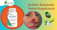 Introducing our revolutionary Herbal Supplement for Actinic Keratosis Natural Treatment – your path to radiant, healthy skin. Say goodbye to the discomfort and unsightly blemishes caused by actinic keratosis and embrace the natural solution that will rejuvenate your skin and boost your confidence.

