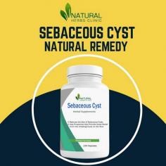 Gain Wisdom about the Sebaceous Cyst Removal Techniques and process including what to expect before, during and after treatment. Understand the risks and benefits of this procedure to decide if it is the right choice for you.
