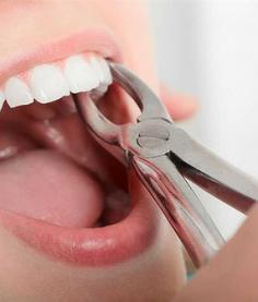 Welcome to Carvolthdentistry.ca, your trusted dentist in Langley. Our team of experienced professionals provides quality care with a personalized touch. Let us help you achieve the smile you've always wanted!