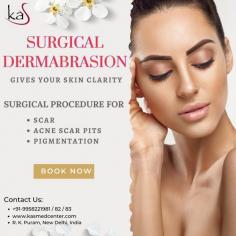 Surgical Dermabrasion: Gives Your Skin Clarity

Surgical Procedure for:

• Scar
• Acne Scar Pits
• Pigmentation

If you are thinking about getting a #surgicaldermabrasion procedure in Delhi, India, set up an appointment with Dr. Ajaya Kashyap and discuss it.

Visit: www.kasmedcenter.com