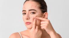 Discover personalised acne solutions in Farnham Common and surrounding areas. Book now for clear, radiant skin. Expert care for all ages and skin types in the UK.