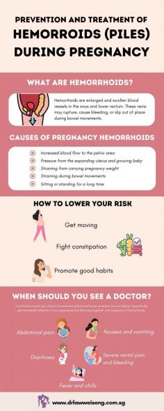 Are you worried that you may get hemorrhoids when you are expecting?  There's nowhere else to look! You're covered by our educational infographic, "How to Prevent Hemorrhoids (Piles) During Pregnancy." 
Learn simple strategies and tactics to prevent hemorrhoids while you take care of the priceless life that is developing inside of you. This infographic offers helpful tips to reduce pain and avoid hemorrhoids during this unique time, from eating a balanced diet and drinking plenty of water to using the restroom correctly and doing light exercise.
Hemorrhoids shouldn't take away from the delight of being pregnant. See a qualified gynecologist at Women's Clinic Singapore for individualized advice and more knowledge on enhancing your general health during your pregnancy.

Source: https://www.drlawweiseng.com.sg/blog/prevention-and-treatment-of-hemorrhoids-piles-during-pregnancy/
