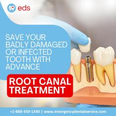 Root Canal Treatment | Emergency Dental Service

Save your badly damaged or infected tooth with advanced root canal treatment at the Emergency Dental Service. Our expert doctors can save your tooth, reducing pain and improving your smile. Don't suffer any longer—contact us now for expert care. Schedule an appointment at 1-888-350-1340.