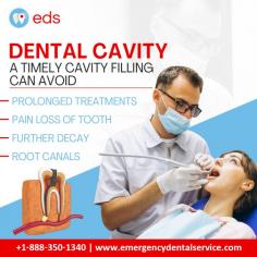 Dental Cavity | Emergency Dental Service 

It is crucial to get a cavity filled on time to avoid prolonged treatments, pain, loss of teeth, further decay, and the need for root canals. Emergency Dental Service can promptly address these issues. By getting a cavity filled immediately, you can prevent all of these problems. Schedule an appointment at 1-888-350-1340. 