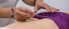 Get the Best Traditional Chinese Acupuncture in Marylebone at Vanessa Rubio Acupuncture. Visit for more information- https://maps.app.goo.gl/PE5GhkamWo5rfoQE6