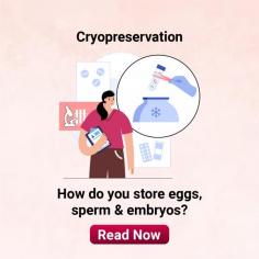 Cryopreservation: Understand Embryo Freezing Importance in IVF at Indira IVF

Cryopreservation: Cryopreservation is a process which helps in women infertility treatment. Understand the importance of embryo freezing at Indira IVF. For more details, visit: https://www.indiraivf.com/fertility-preservation/cryopreservation
