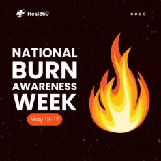 Did you know it's National Burns Awareness Week? Let's delve into the essentials of outdoor safety! From the scorching sun to potential contact burns, comprehending the risks and taking preemptive measures is paramount. Remember to apply sunscreen generously, keep yourself hydrated, and exercise caution around hot surfaces or flames. Let's relish nature's beauty while prioritizing safety.

And while you're focusing on safety outdoors, remember that Heal360 is here to support your overall well-being. Our comprehensive healthcare services include guidance on preventive measures and treatments for burns. Stay safe, stay informed, and enjoy the great outdoors responsibly!

To learn more about our services and how we can assist you, visit Heal360 at https://www.heal360.com.